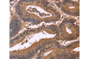Immunohistochemistry (IHC) image for anti-Cell Division Cycle 37-Like 1 (CDC37L1) antibody (ABIN2429747) (CDC37L1 Antikörper)