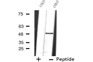 Western blot analysis of extracts from COLO cells using PRPF19 antibody.