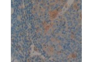 IHC-P analysis of Human Tissue, with DAB staining. (IL1F9 Antikörper  (AA 1-158))