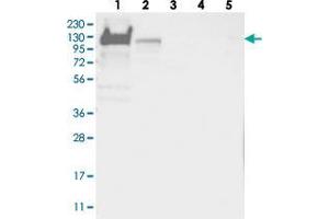 Western blot analysis of Lane 1: RT-4, Lane 2: U-251 MG, Lane 3: Human Plasma, Lane 4: Liver, Lane 5: Tonsil with YTHDC1 polyclonal antibody  at 1:250-1:500 dilution. (YTHDC1 Antikörper)
