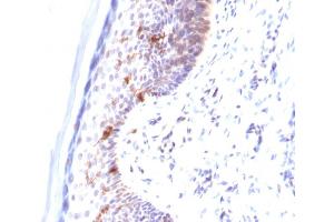 Formalin-fixed, paraffin-embedded human Skin stained with CD1a Mouse Monoclonal Antibody (C1A/711). (CD1a Antikörper)