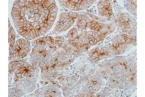 Immunohistochemistry (IHC) image for anti-Carcinoembryonic Antigen-Related Cell Adhesion Molecule 1 (CEACAM1) (AA 35-433) antibody (ABIN7455148) (Rekombinanter CEACAM1 Antikörper  (AA 35-433))