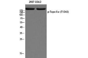 Western Blot (WB) analysis of 293T COLO205 using p-Topo IIalpha (T1343) antibody. (Topo IIalpha (pThr1343) Antikörper)