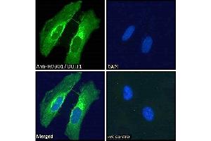 ABIN185537 Immunofluorescence analysis of paraformaldehyde fixed HeLa cells, permeabilized with 0. (ROBO1 Antikörper  (Internal Region))