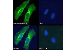 ABIN185537 Immunofluorescence analysis of paraformaldehyde fixed HeLa cells, permeabilized with 0.