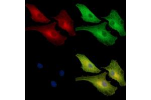 ABIN7097091 and ABIN7101158 staining  cells by IF/ICC. (NCF1C Antikörper)
