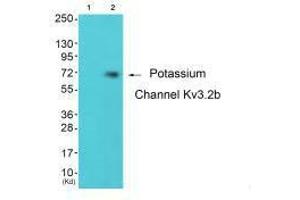 Western blot analysis of extracts from 293 cells (Lane 2), using Potassium Channel Kv3. (KCNC2 Antikörper)