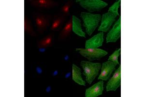 Phospho-NLRC4 (Ser533) Antibody staining A549 cells(heat shock treatment) by IF/ICC. (NLRC4 Antikörper  (pSer533))