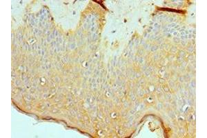 Immunohistochemistry of paraffin-embedded human skin tissue using ABIN7160711 at dilution of 1:100 (ASMTL Antikörper  (AA 1-290))