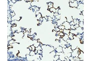 IHC analysis of RAGE/AGER using anti-RAGE/AGER antibody (ABIN7601722).