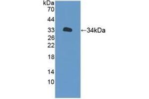 Detection of Recombinant XYLT2, Human using Polyclonal Antibody to Xylosyltransferase II (XYLT2) (XYLT2 Antikörper  (AA 596-865))
