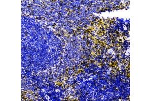 IHC analysis of ZEB2 using anti-ZEB2 antibody (ABIN3042325).