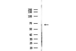anti-Steroid Sulfatase (Microsomal), Isozyme S (STS) (C-Term) antibody
