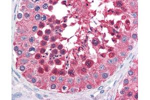 Anti-HSPA4L antibody IHC of human testis. (HSPA4L Antikörper  (AA 825-839))