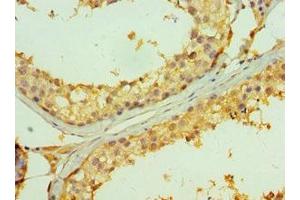 Immunohistochemistry (IHC) image for anti-Tumor Necrosis Factor Receptor Superfamily, Member 13B (TNFRSF13B) (AA 184-293) antibody (ABIN7173851)