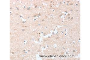 Immunohistochemistry of Human brain  using LY96 Polyclonal Antibody at dilution of 1:20