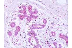 Anti-Syntenin antibody IHC of human breast. (SDCBP Antikörper  (AA 6-19))