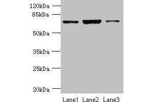 Western blot All lanes: CCDC116 antibody at 1. (CCDC116 Antikörper  (AA 1-300))