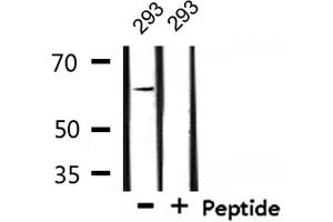Western blot analysis of extracts from 293, using TGFR2 Antibody. (TGFBR2 Antikörper  (Internal Region))