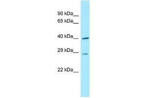 WB Suggested Anti-Dnajc11 Antibody Titration: 1.