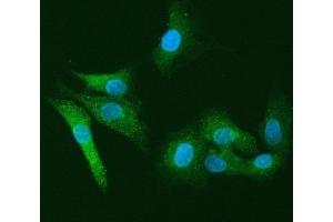IF analysis of PI2/SERPINB1 using anti-PI2/SERPINB1 antibody (ABIN7601949).