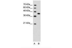 Image no. 2 for anti-Carcinoembryonic Antigen-Related Cell Adhesion Molecule 6 (CEACAM6) (AA 216-265) antibody (ABIN203400) (CEACAM6 Antikörper  (AA 216-265))