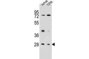 Western Blotting (WB) image for anti-Tetraspanin 26 (TSPAN26) antibody (ABIN2995796) (CD37 Antikörper)