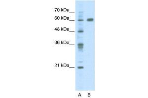 WB Suggested Anti-PDLIM5  Antibody Titration: 2. (PDLIM5 Antikörper  (C-Term))