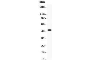 Western Blotting (WB) image for anti-Inositol 1,4,5-Trisphosphate Receptor, Type 3 (ITPR3) (AA 2411-2758) antibody (ABIN3031328)