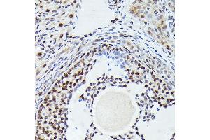 Immunohistochemistry of paraffin-embedded rat ovary using [KO Validated] CDK4 Rabbit mAb  at dilution of 1:100 (40x lens). (CDK4 Antikörper)