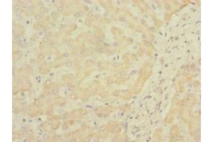 Immunohistochemistry of paraffin-embedded human liver tissue using ABIN7170777 at dilution of 1:100 (SOAT2 Antikörper  (AA 1-120))