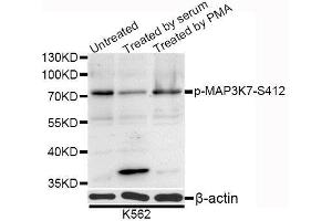 Western blot analysis of extracts of K-562 cells, using Phospho-MAP3K7-S412 antibody (ABIN5995645) at 1/1000 dilution. (MAP3K7 Antikörper  (pSer439))