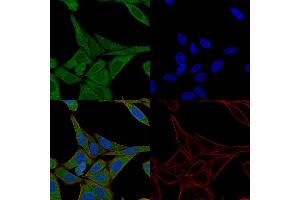 Immunofluorescence (IF) image for anti-Fascin (FSCN1) antibody (ABIN6940607)
