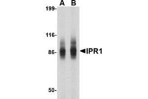 Western Blotting (WB) image for anti-SP110 Nuclear Body Protein (SP110) (N-Term) antibody (ABIN1031418) (SP110 Antikörper  (N-Term))