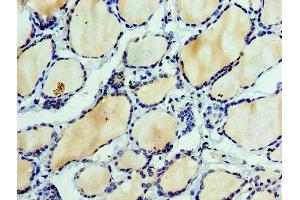 Immunohistochemistry of paraffin-embedded human thyroid tissue using ABIN7151875 at dilution of 1:100 (Ephrin A3 Antikörper  (AA 23-214))