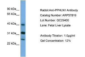 WB Suggested Anti-PPHLN1  Antibody Titration: 0. (PPHLN1 Antikörper  (N-Term))