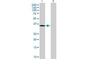 Western Blot analysis of HLA-DRA expression in transfected 293T cell line by HLA-DRA MaxPab polyclonal antibody. (HLA-DRA Antikörper  (AA 1-254))
