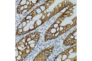 Immunohistochemistry of paraffin-embedded human colon using CLDN3 antibody (ABIN3017039, ABIN3017040, ABIN3017041, ABIN1679261 and ABIN6219930) (40x lens). (Claudin 3 Antikörper)