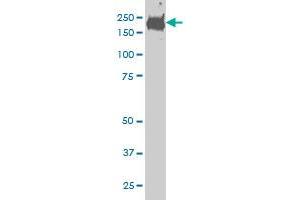 CDC42BPB monoclonal antibody (M02), clone 6G3 Western Blot analysis of CDC42BPB expression in HeLa . (CDC42BPB Antikörper  (AA 1580-1679))