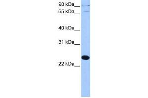 Western Blotting (WB) image for anti-Thyroid Hormone Receptor Associated Protein 3 Pseudogene 1 (THRAP3P1) antibody (ABIN2459455) (THRAP3P1 Antikörper)