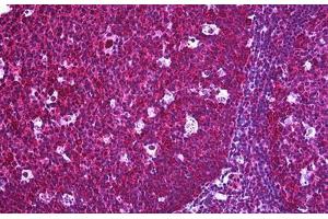 Human Tonsil: Formalin-Fixed, Paraffin-Embedded (FFPE) (FLIP Antikörper  (AA 178-277))