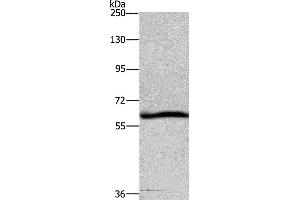 Western blot analysis of Hela cell, using DCP1A Polyclonal Antibody at dilution of 1:1100 (DCP1A Antikörper)