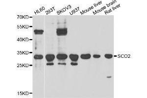 Western blot analysis of extracts of various cell lines, using SCO2 antibody. (SCO2 Antikörper)