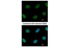 ICC/IF Image Immunofluorescence analysis of paraformaldehyde-fixed HeLa, using ZEB1, antibody at 1:1000 dilution.