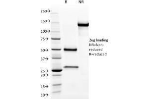 SDS-PAGE Analysis Purified Aurora B Mouse Monoclonal Antibody (AURKB/1593). (Aurora Kinase B Antikörper  (AA 89-251))