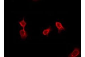 ABIN6276012 staining Hela by IF/ICC. (GPR144 Antikörper)