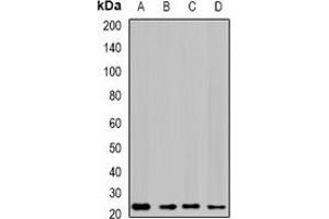 Western blot analysis of GTL3 expression in SKOV3 (A), HepG2 (B), mouse liver (C), rat lung (D) whole cell lysates. (C16orf80 Antikörper)