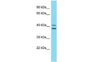 Host:  Rabbit  Target Name:  ZNF414  Sample Type:  Stomach Tumor lysates  Antibody Dilution:  1. (ZNF414 Antikörper  (C-Term))