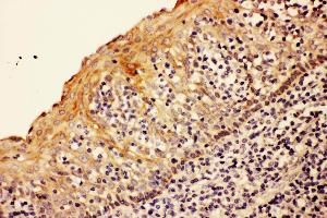 Anti- CASP8 antibody,IHC(P) IHC(P): Human Tonsil Tissue