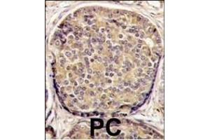anti-PI3KCB (AA 713-744), (C-Term) antibody